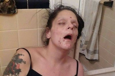 Woman-Shares-Graphic-Photos-to-Show-Addiction.jpg